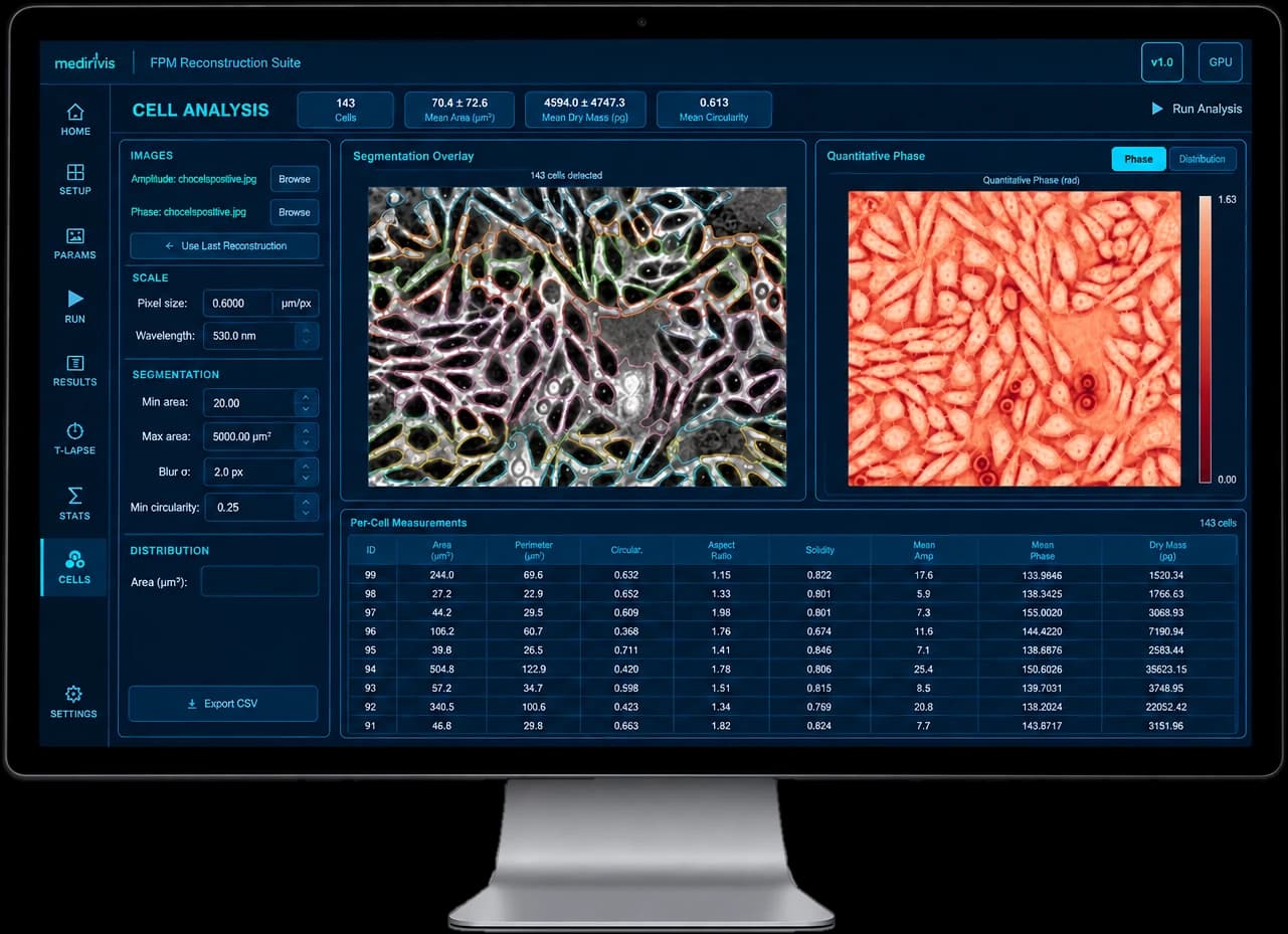 Medirevs imaging software analysis screen on a desktop monitor, showing a segmentation overlay, quantitative phase image, and per-cell measurements